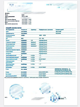 Купить общий анализ мочи (форма 210/у) в Москве.